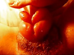 Benjolan hitam di daerah anal besar dipompa pussy nice big pussy lips